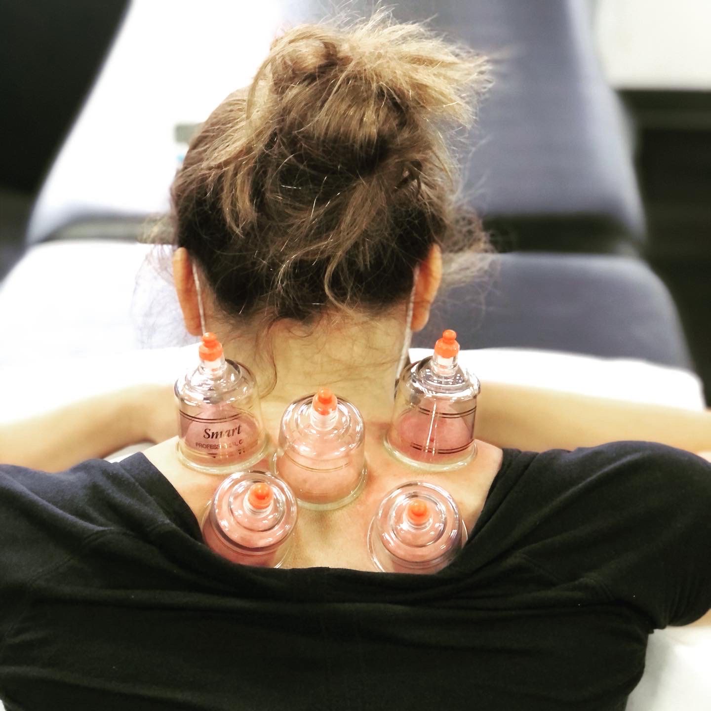 Neckpain-cupping